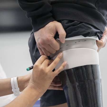 bovenbeen prothese op maat